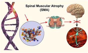 Counseling and Genetic Diagnosis of Spinal Muscular Atrophy